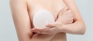Nâng ngực có ảnh hưởng gì không?
